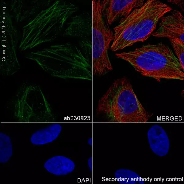 Anti-non-muscle Myosin IIB/MYH10 antibody [EPR22564-23](AB230823)