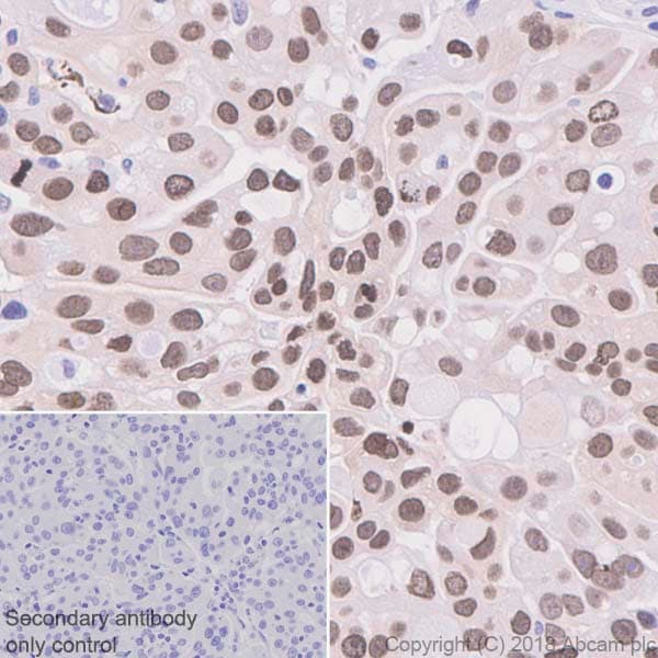 Anti-BANF1/BAF antibody [EPR7668](AB129184)