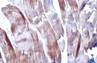 Anti-Sarcomeric Alpha Actinin antibody(AB137346)