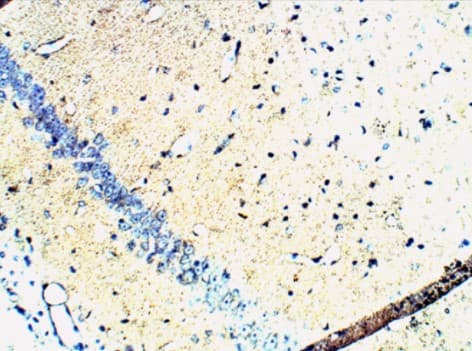 Anti-Synaptophysin antibody(AB14692)