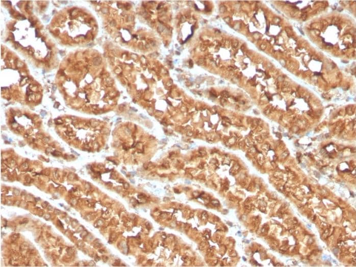 Cd134 Ox40l Receptor Antibody Ox40 3108 Ab270727  Immunohistochemistry Formalin Pfa Fixed Paraffin Embedded Sections Img73490