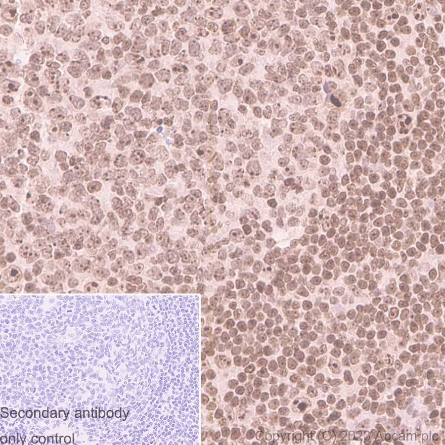 Antigen Retrieval Buffer 100x Citrate Buffer Ab93678 Immunohistochemistry Formalin Pfa Fixed Paraffin Embedded S AYt7fVuEN7