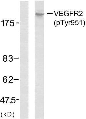 Anti-VEGF Receptor 2 (phospho Y951) antibody(AB38473)