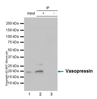 Anti-Vasopressin antibody [EPR20602](AB213708)