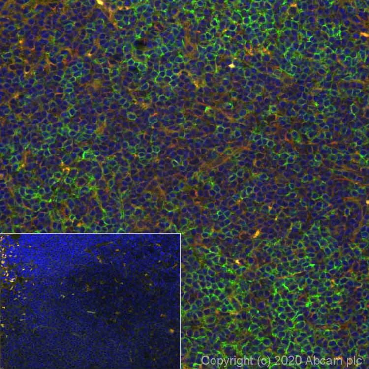 Alexa Fluor 488 Cd4 Antibody Epr19514 Ab277275  Immunohistochemistry Formalin Pfa Fixed Paraffin Embedded Sections Img97870
