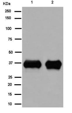 Anti-PHOX2B antibody [EPR14423] - C-terminal(AB183741)