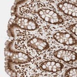 Kiaa1107 Apache Antibody Ab121799  Immunohistochemistry Formalin Pfa Fixed Paraffin Embedded Sections Img31996