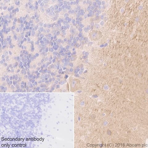 Anti-Tenascin C antibody [EPR4219](AB108930)