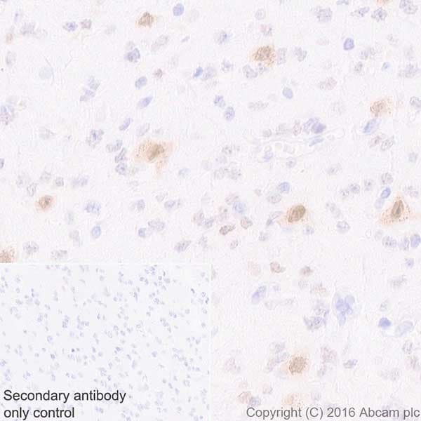 Anti-HuD + HuC antibody [EPR19098](AB184267)