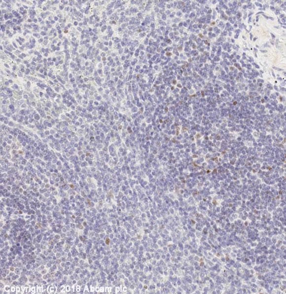 Foxp3 Antibody Epr15038 69 Ab191416  Immunohistochemistry Formalin Pfa Fixed Paraffin Embedded Sections Img100811
