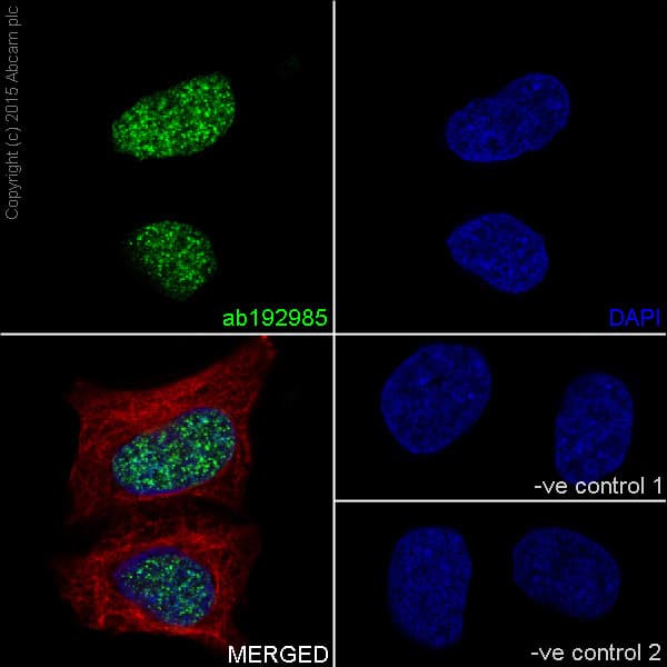 Anti-Histone H3 (tri methyl K27) antibody [EPR18607] - ChIP Grade(AB192985)