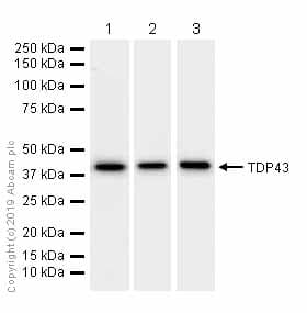 Anti-TDP43 antibody [EPR5810](AB109535)