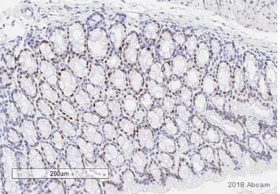 Anti-STAT3 (phospho Y705) antibody [EP2147Y](AB76315)
