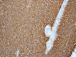 Anti-Cytokeratin 20 antibody [EPR1622Y] - BSA and Azide free(AB219589)