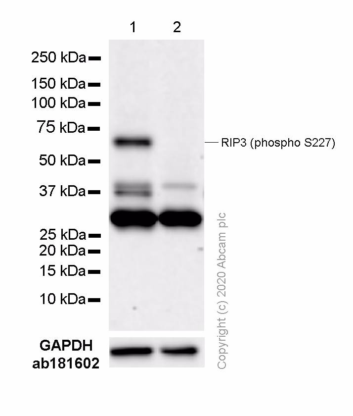 Rip3 Phospho S227 Antibody Epr9627 Ab209384 Western Blot Img60029