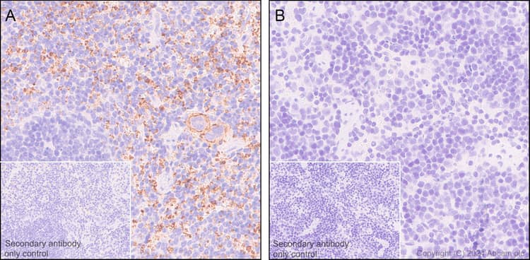Anti-CD42b antibody [SP219](AB183345)