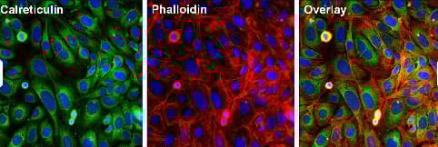 Anti-Calreticulin antibody - ER Marker(AB2907)