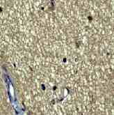 Anti-Huntingtin antibody [EP867Y](AB45169)