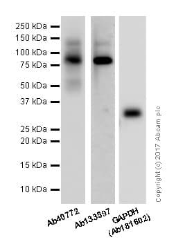 Anti-E Cadherin antibody [EP700Y] - Intercellular Junction Marker(AB40772)