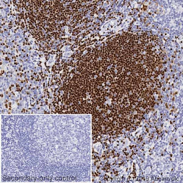 Pax5 Antibody 1h9 Ab211293  Immunohistochemistry Formalin Pfa Fixed Paraffin Embedded Sections Img46785