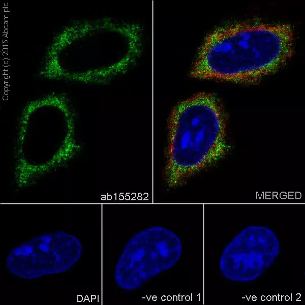 Anti-FACL4 antibody [EPR8640](AB155282)