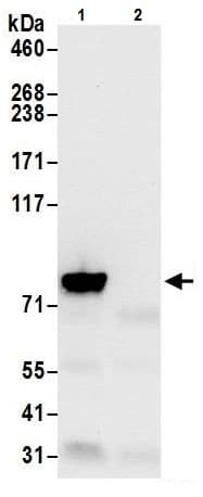 Anti-VPS35 antibody - C-terminal(AB226180)