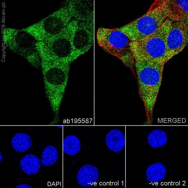 Anti-CNOT7 antibody [EPR18722](AB195587)