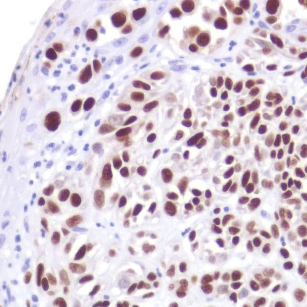 Anti-SOX10 antibody [SP267] - BSA and Azide free(AB245760)