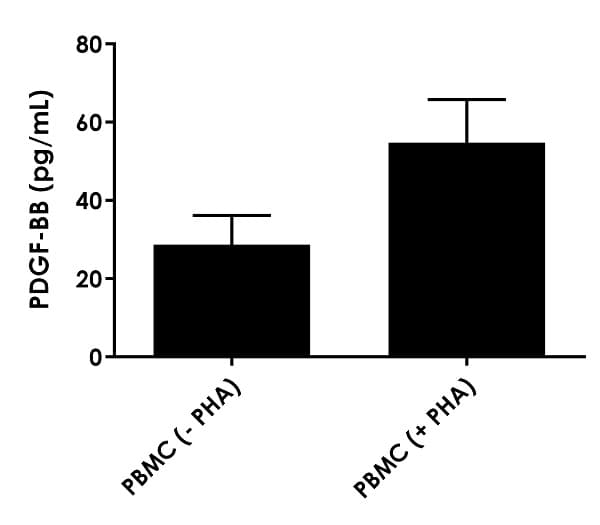 Human PDGF BB ELISA Kit(AB184860)