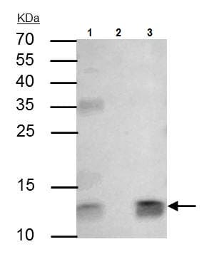 Beta 2 Microglobulin Antibody Ab227261  Immunoprecipitation Img50043