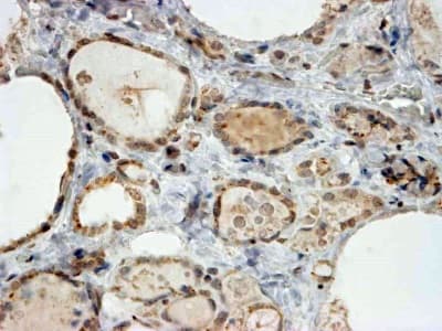 Anti-PAX8 antibody(AB13611)