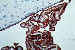 Anti-Aquaporin 1 antibody [1/22](ab9566)