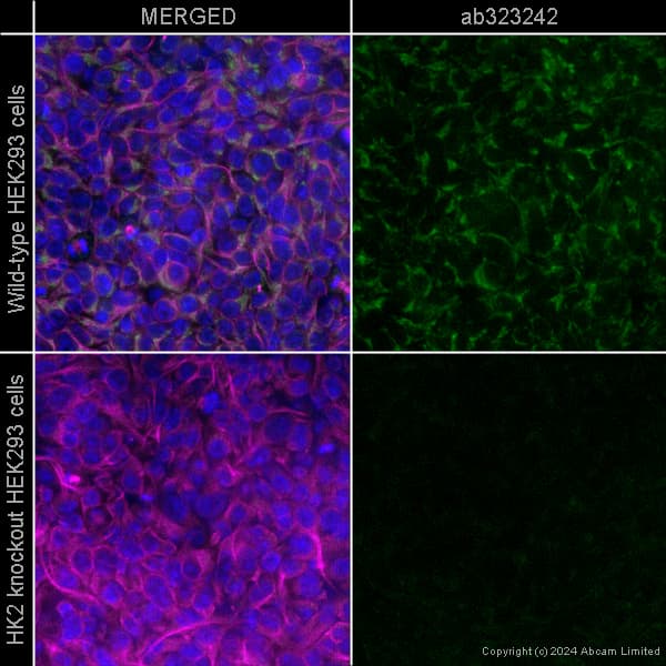 Alexa Fluor 594 Alpha Tubulin Antibody Ep1332y Microtubule Marker Ab202272  Immunocytochemistry Immunofluorescence Img440845