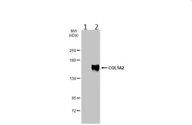 Anti-COL1A2 antibody(AB96723)