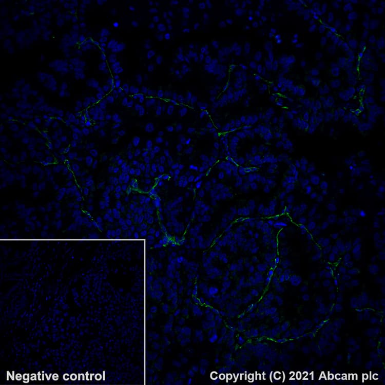 Alexa Fluor® 488 Anti-CD31 antibody [EPR3094](AB275989)