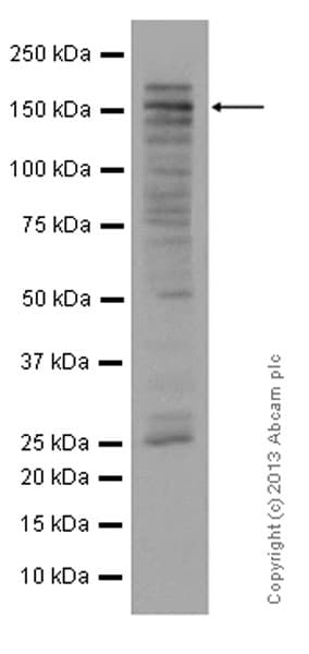 Anti-KDM5B / PLU1 / Jarid1B antibody [EPR12704](AB181089)