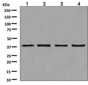 Mh2a1 Antibody Epr9358 Ab137117  Western Blot Img105110
