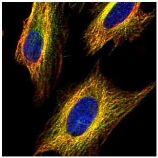 Anti-VDAC2 antibody - C-terminal(AB155803)