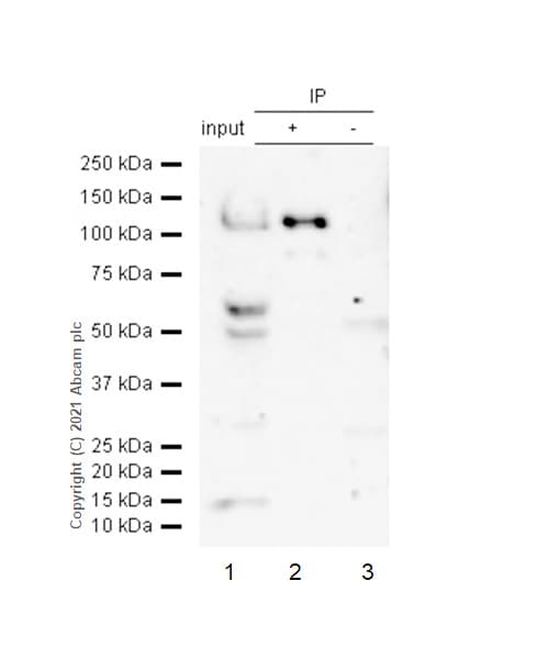 Usp10 Antibody Epr4261 Bsa And Azide Free Ab239953  Immunoprecipitation Img164845