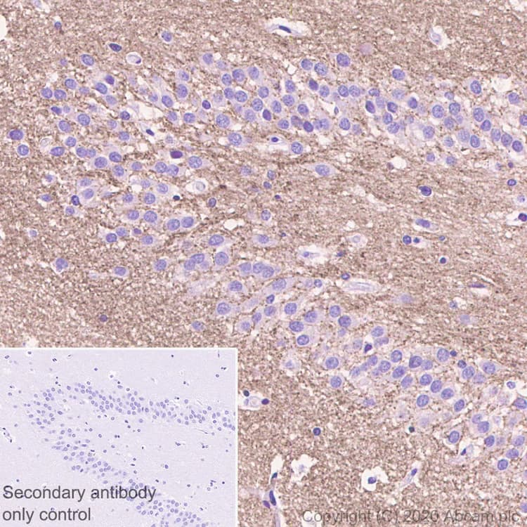 Synaptic Marker (Synaptophysin, Synapsin1, PSD95, VAMP2) Antibody Sampler Panel - Human, Mouse(AB263463)