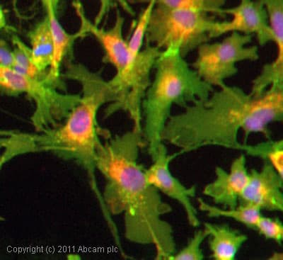 Anti-Glucose Transporter GLUT1 antibody(AB15309)