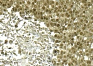 Anti-Vimentin antibody [RV202] - Cytoskeleton Marker(ab8978)