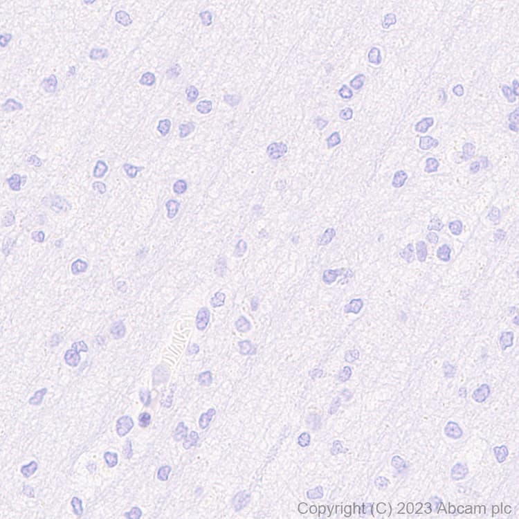 Anti-Neutrophil Elastase antibody [RM1077](AB314916)