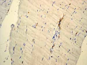 Anti-CD45 antibody [EP322Y](AB40763)