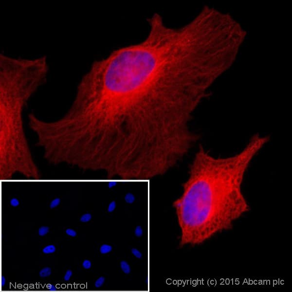Donkey Anti-Rabbit IgG H&L (Alexa Fluor® 647)(AB150075)