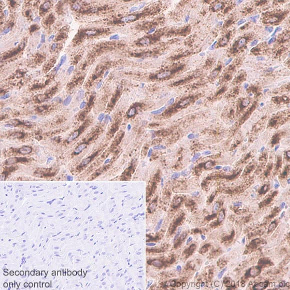 Natriuretic Peptides A Antibody Epr22089 283 Ab225844  Immunohistochemistry Formalin Pfa Fixed Paraffin Embedded Sections Img57918