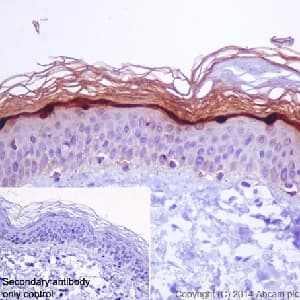 Loricrin Antibody Epr71492 C Terminal Ab198994  Immunohistochemistry Formalin Pfa Fixed Paraffin Embedded Sections Img128931