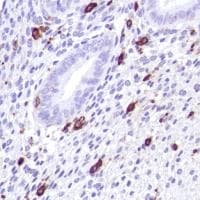 Anti-CD14 antibody [SP192](AB183322)