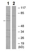 Anti-YTHDF1 antibody(AB230330)