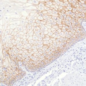 Anti-TROP2 antibody [SP293] - BSA and Azide free(AB272014)